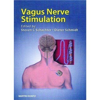Vagus Nerve Stimulation eBook Dieter Schmidt MD, Steven C. Schachter